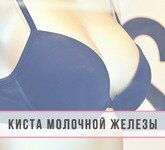 Киста молочной железы. Коварство опасного заболевания