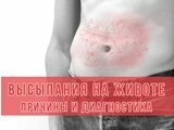 Высыпания на животе у взрослых и детей - в чем может быть причина?